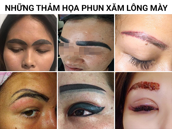 5 Cách Xóa Sửa Dáng Mày Cũ Hỏng Cho Người Muốn Mở Tiệm 7 Dấu hiệu xăm chân mày hỏng và cách khắc phục - Thẩm mỹ Bác sĩ Thuận