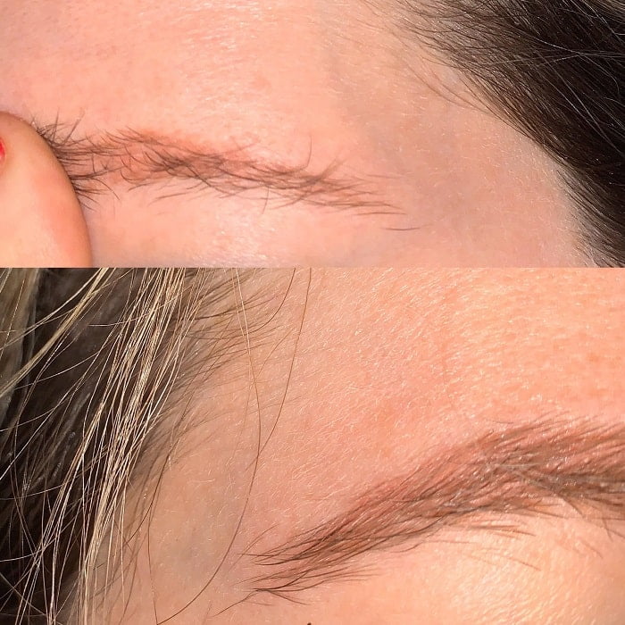 Cách Xử Lý Chân Mày Trổ Xanh Đỏ Mở Tiệm Kinh Doanh 5 Chân mày trổ xanh trổ đỏ và Cách khắc phục